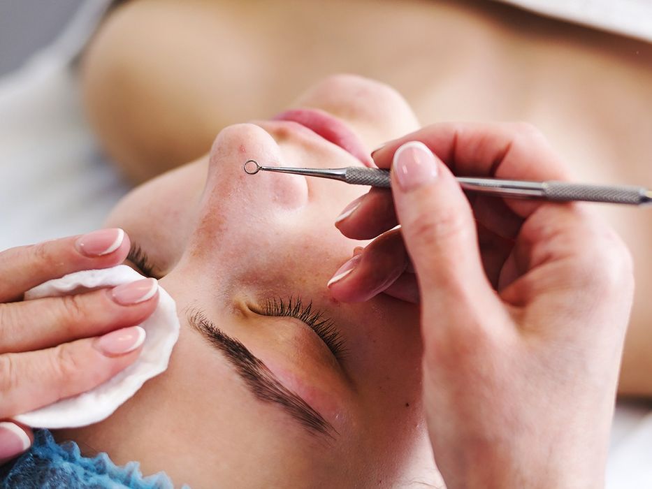 Механическая чистка лица