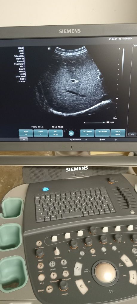 Ecograf Doppler color Siemens