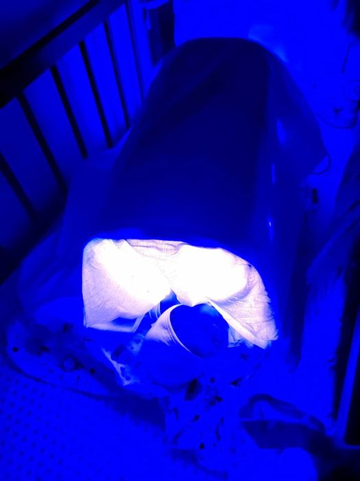 Новая билирубиновая Фотолампа от желтушки для детей (кювез фотосинтез)