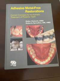 Adhesive metal free restorations