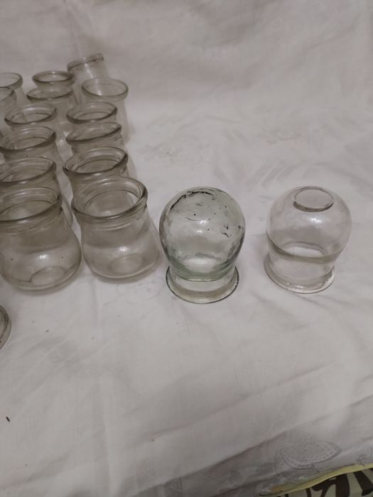 Ventuze medicinale 34 bucăți