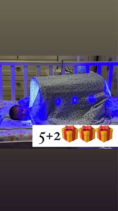 Фотолампа. Лампа от желтушки