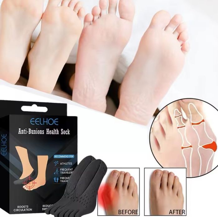 Ортопедични чорапи за изкривяване на палеца и изпъкнали кокалчета