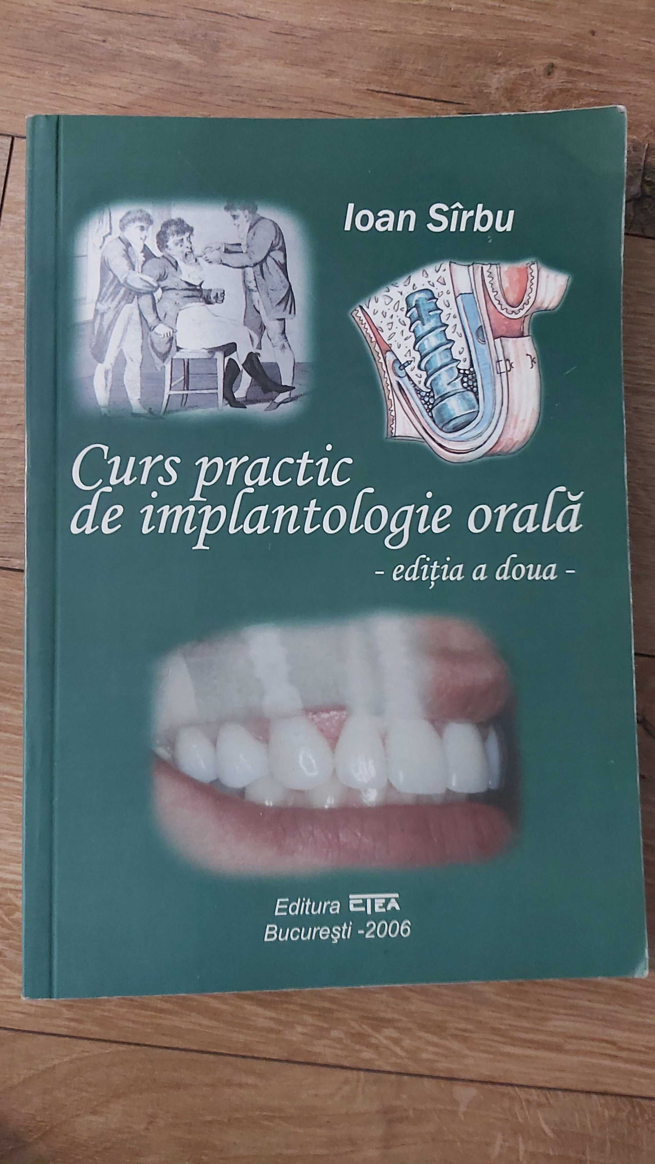 Curs practic de implantologie orala Ioan Sarbu