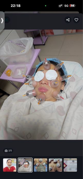 Пиявки Астана - Гирудотерапия