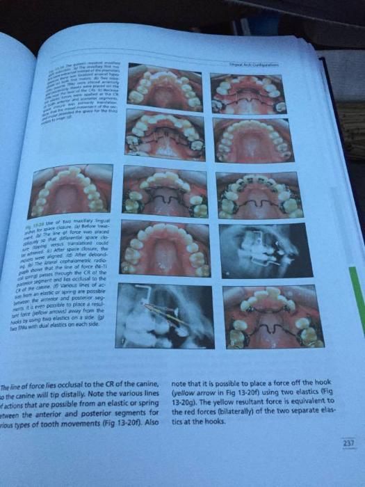 The Biomechanical Foundation of Clinical Orthodontics 2015