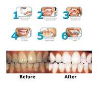 Ефикасните ленти Advanced Teeth Whitening за избелване на зъбите
