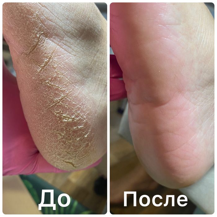 КЖБИ:маникюр- педикюр-шугаринг-брови-массаж