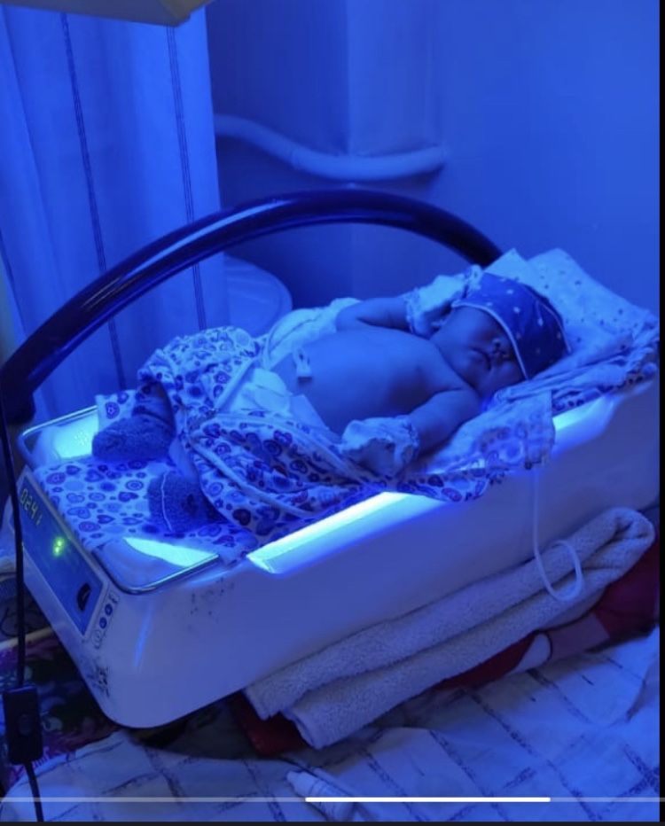 Фотолампа от желтушки у новорожденных малышей ( повышенный билирубин)