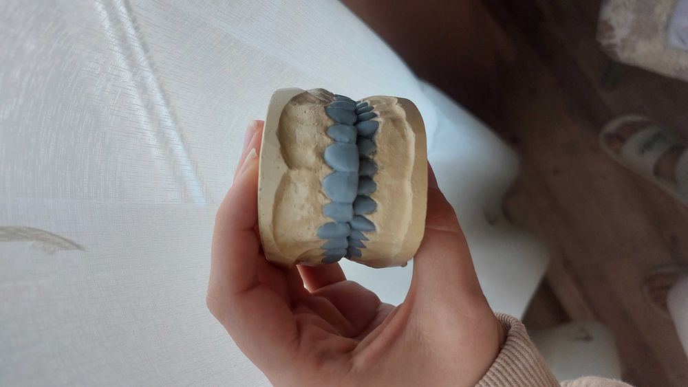 Продавам моделирани зъби 100лв