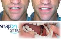 Fatete Dentare Premium - Proteze Dentare Originale