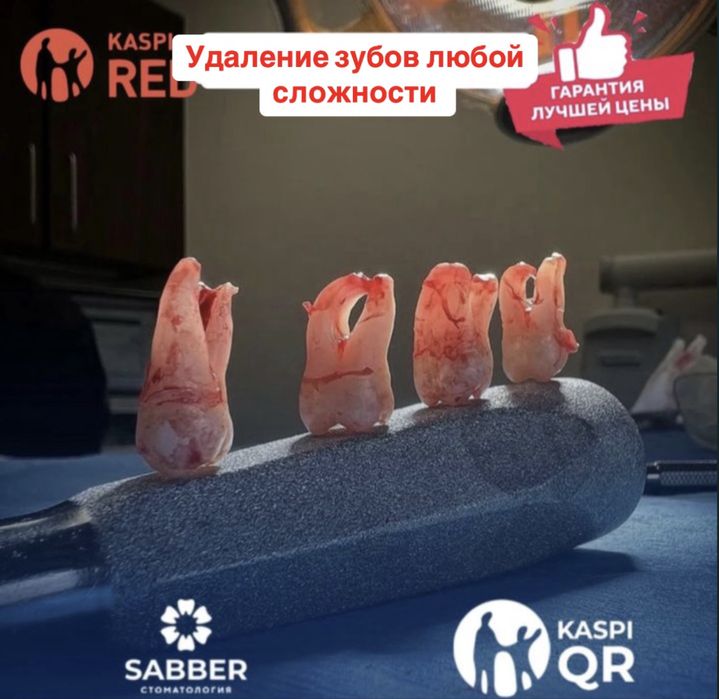 Удаление зуба от 7999. Безболезненно 100%/ Стоматология 24/7