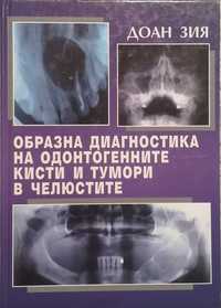 Образна диагностика на одонтогенните кисти и тумори в челюстите