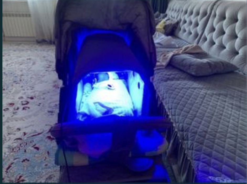 БЕСПЛАТНАЯ доставка/Эффективно 999тг лампы от желтушки/желтухи/Аренда