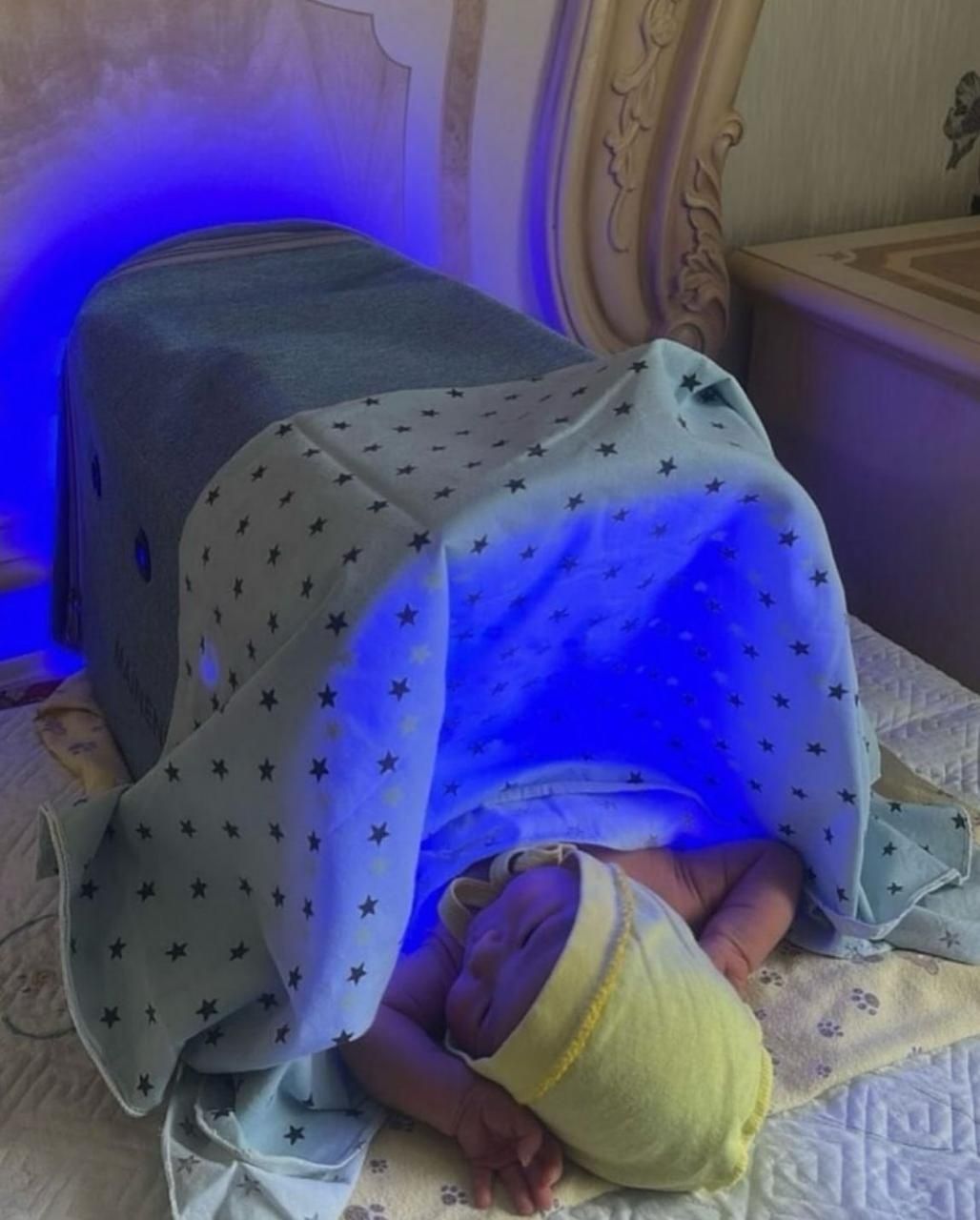 Фотолампа от желтухи для новорожденных