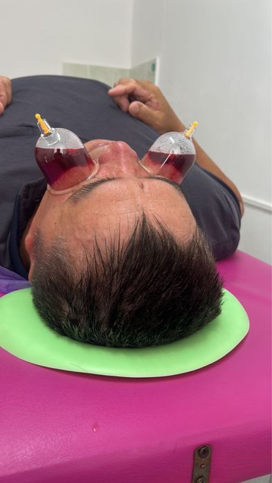 Массаж Хиджама Термокапсула Иглотерапия