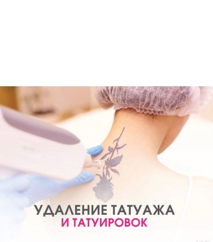 Удаление перманентного татуажа и неудачного тату