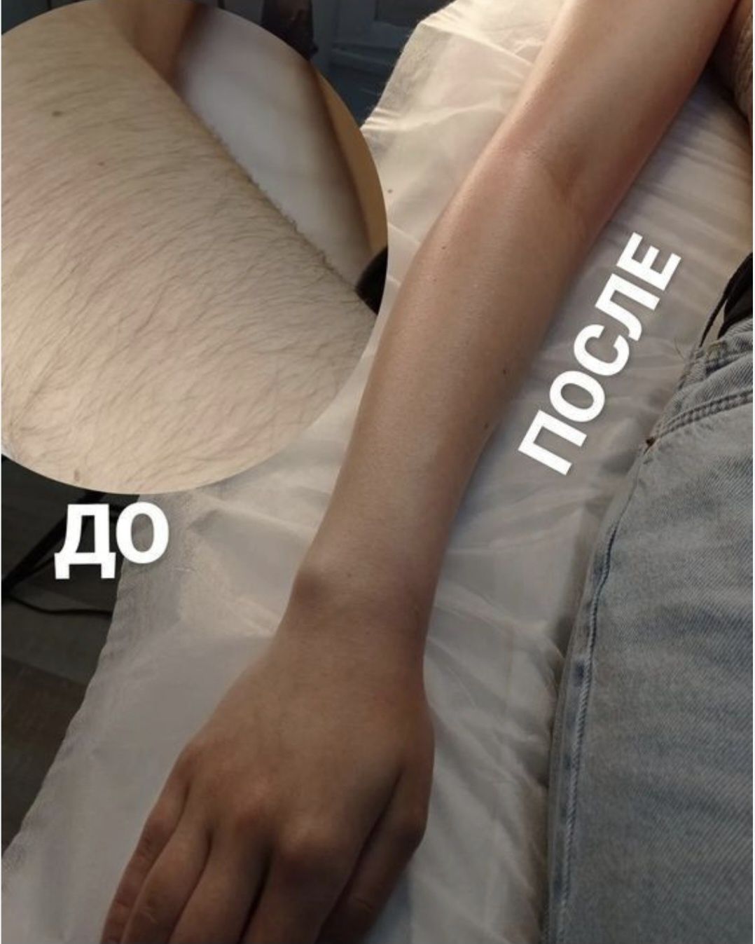 Депиляция мужчинам и женщинам Выезд на дом