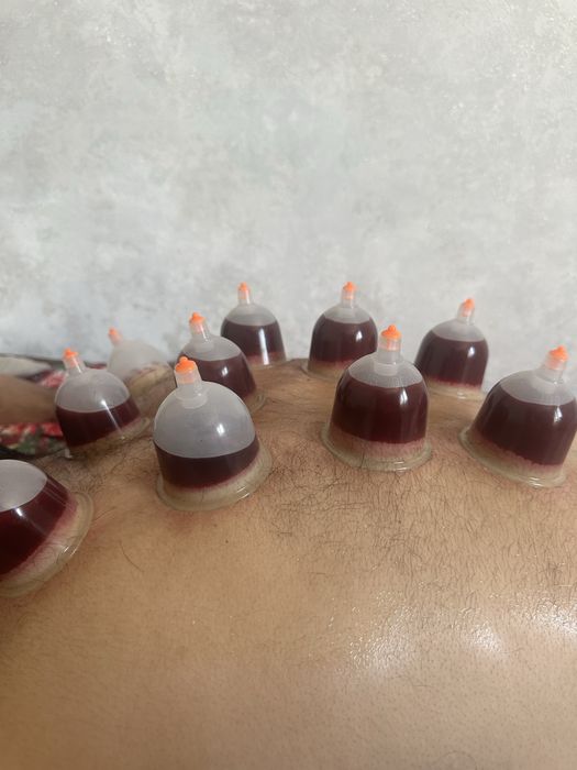 xijoma toshkent shaxar va viloyat boylab uyga borib xizmat korsatamiz