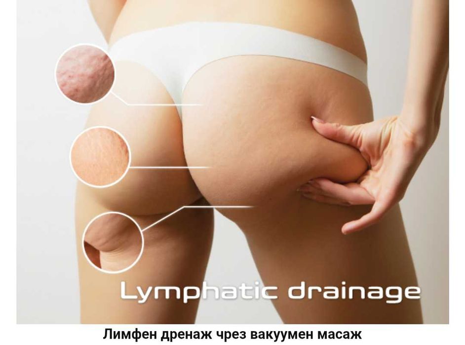 Prorelax вакуумен масажор SENSITIVE антицелулитен масаж с 3 вендузи
