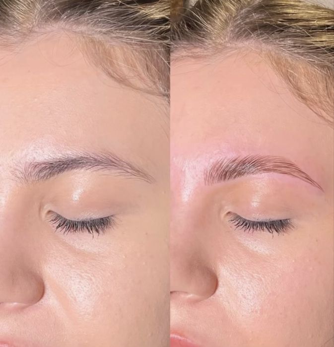 Laminare sprancene /gene