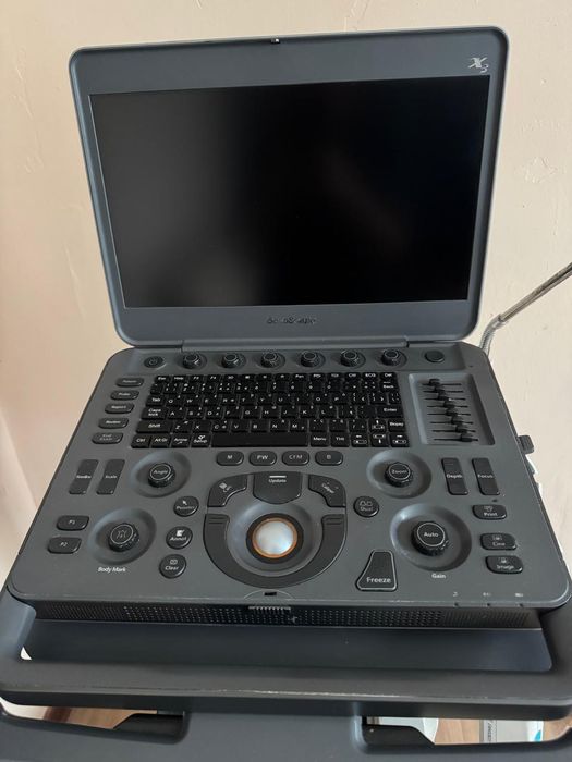 Продам УЗИ аппарат sonoScape x3 + комплект датчиков