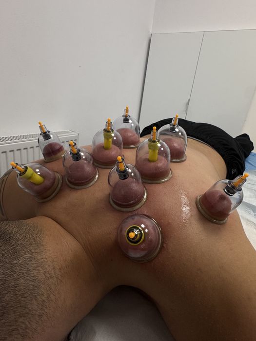 Masaj terapeutic, de relaxare, cupping ventuze