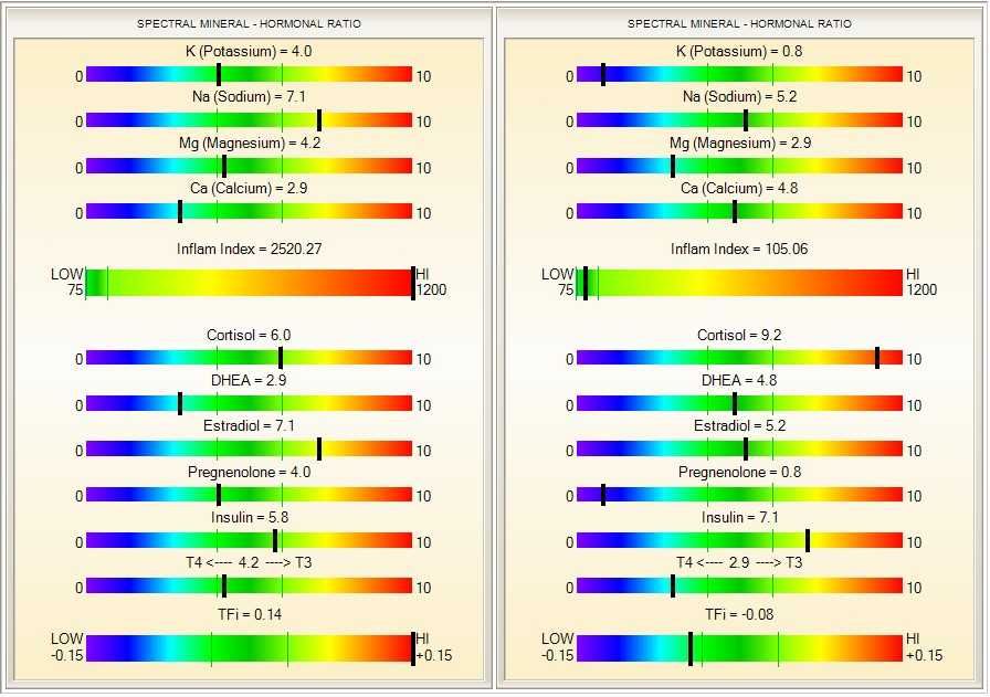 HRV Biofeedback si Biofeedback/Biorezonanta SCIO