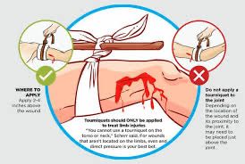 тактически турникет за първа помощ най бързото спиране на кръвозагуба
