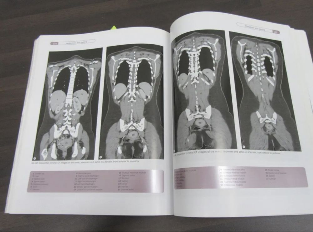 Atlas de anatomie Netter