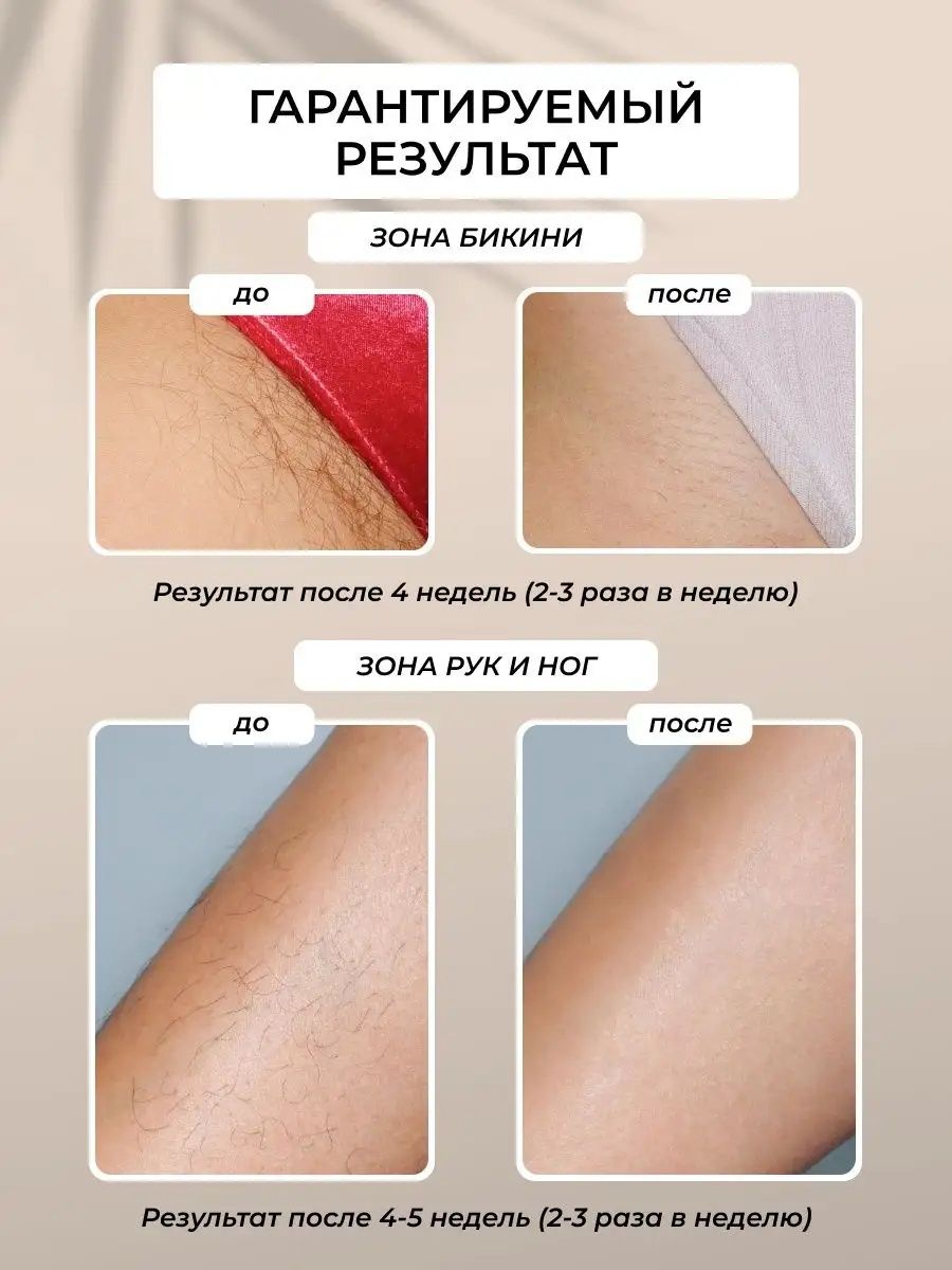 Фотоэпилятор Doctor comfort 2в1 омоложение и антиакне