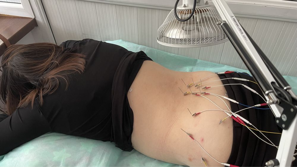 Манульный Терапевт Иглотерапия Иглоукалывание в Алматы Мануалист цена