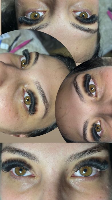 Aplic extensii de gene  1-4D /soft volum / mega volum