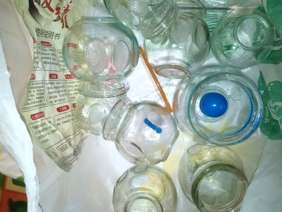 Набор для хиджамы.