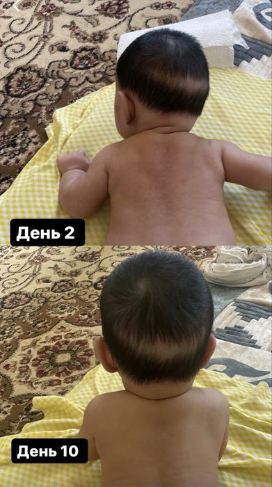 Детский массаж Алматы с выездом