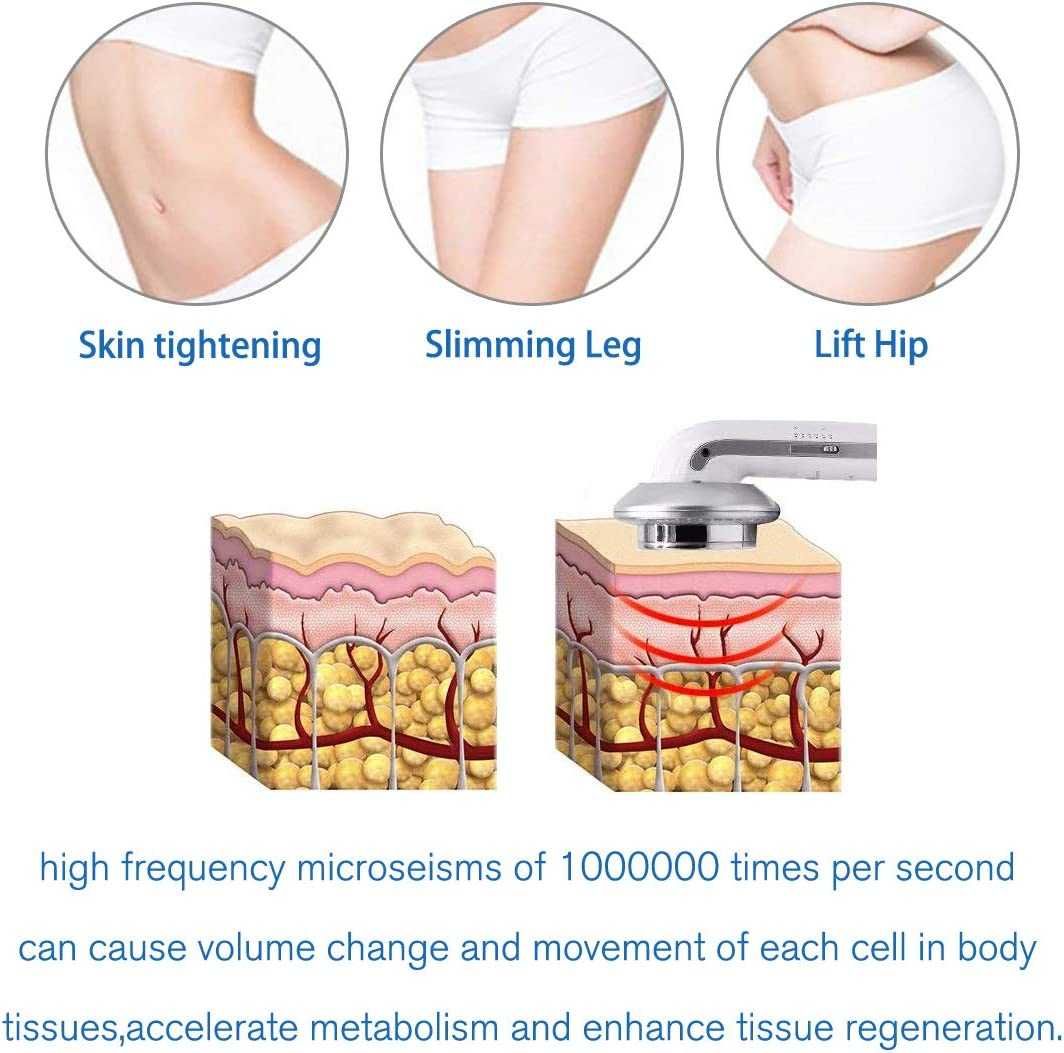 Ултразвуков инфраред + EMS уред за кавитация, лифтинг, скрапинг