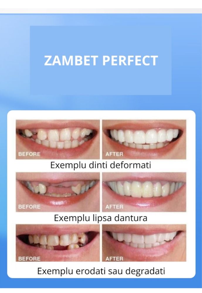 Set fatete dentare