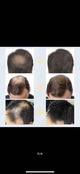 Оргинални Made in USA Кератинови фибри за коса Топпик/Козметика 27.5гр