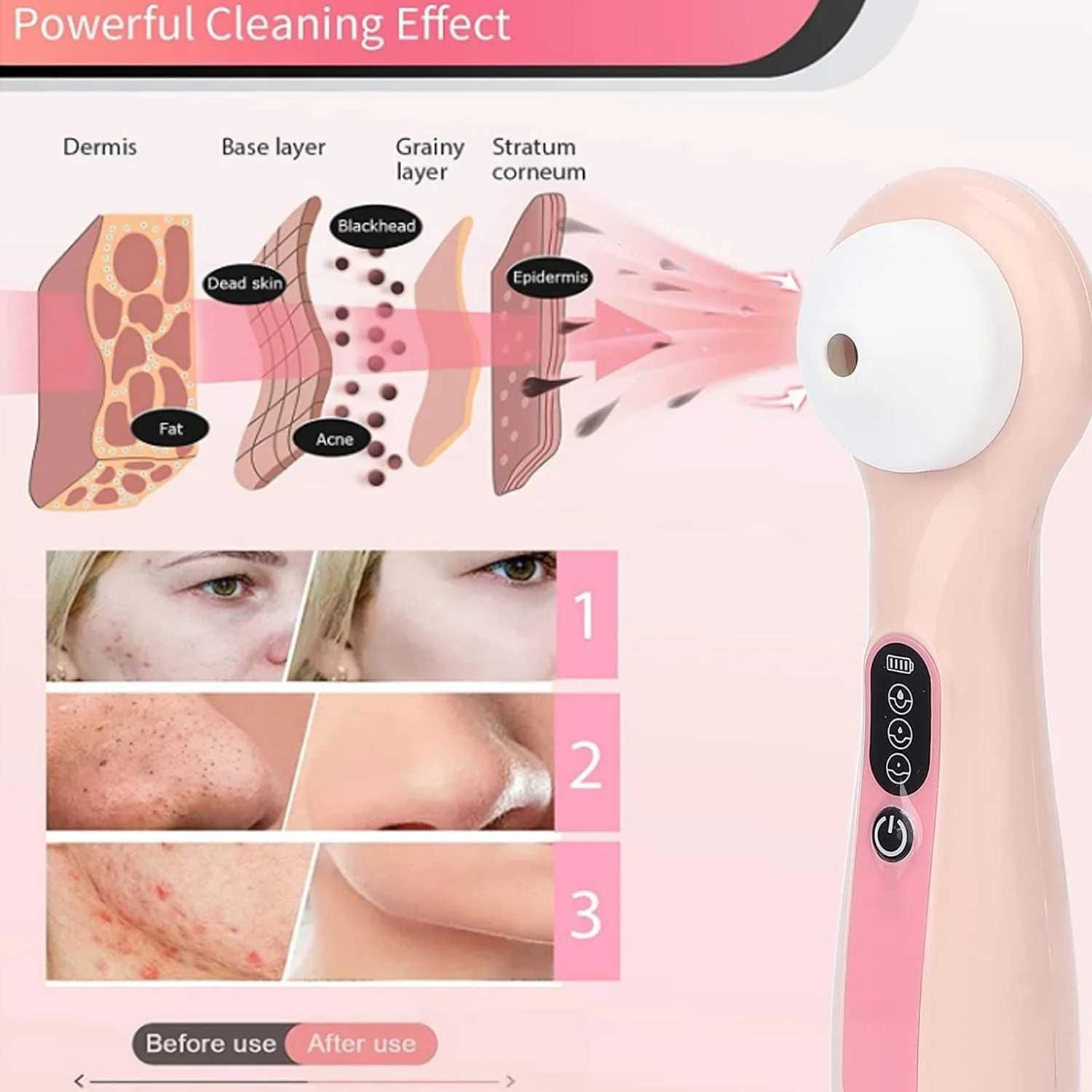 Aparat facial cu vacuum, extragere cosuri cu vizor pentru acnee