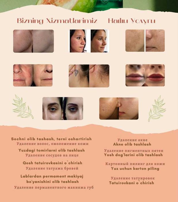 Kosmetologiya uchun 9 funksiyali lazer uskunasi