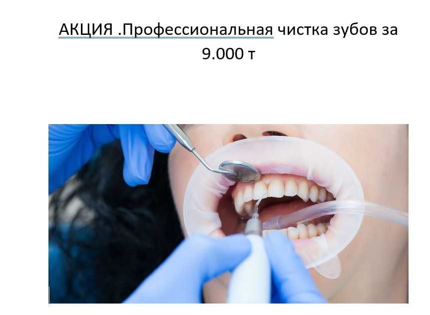 АКЦИЯ .Профессиональная чистка зубов за 9.000 т