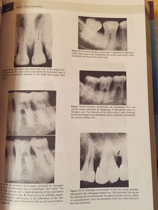 CARRANZA's Clinical Periodontology 13th edition 2018