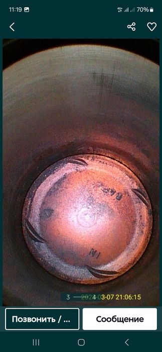 Диагностика эндоскопом.