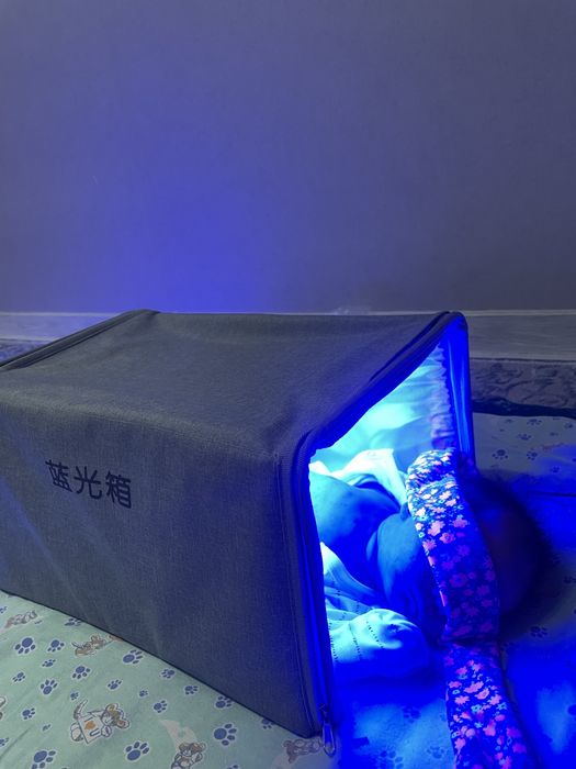 Фотолампа от желтушки Кювез