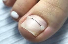 Акции на подологические услуги, педикюр, маникюр с покрытием