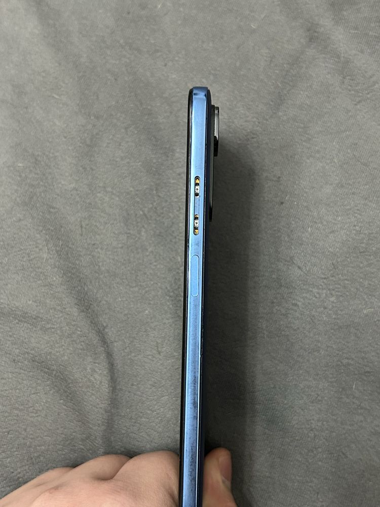 Redmi note 11S