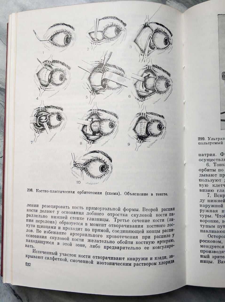 Руководство по глазной Хирургии. Краснова. Беляева.