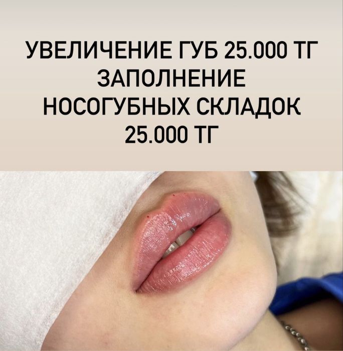 Увеличение губ.  Сертифицированный препараты