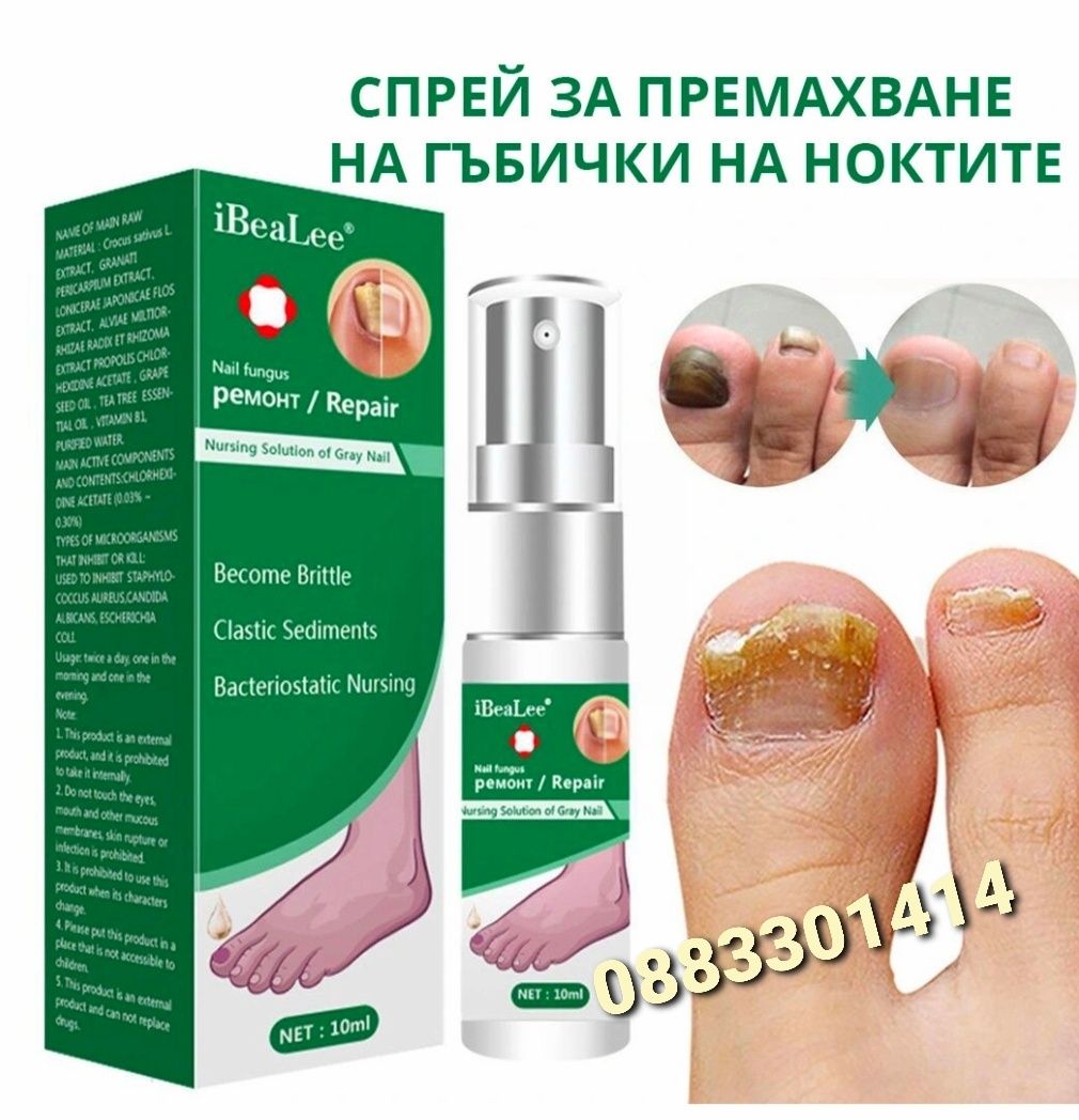 Спрей за нокти Премахва гъбички на ноктите