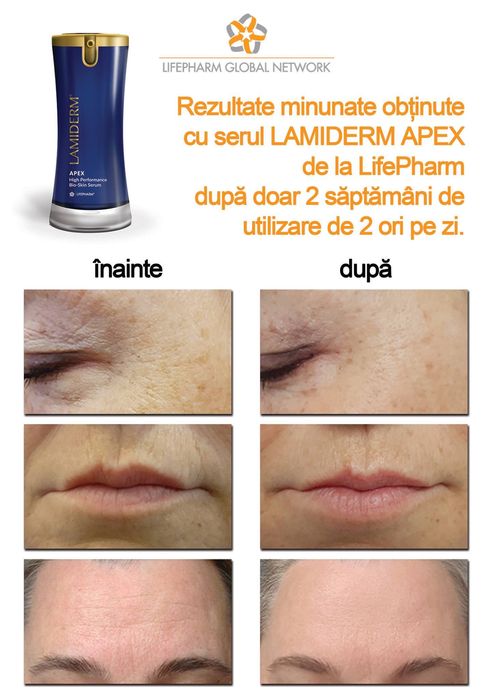 Lamiderm serum Apex – serul de piele
